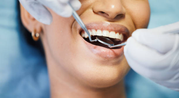 Best Urgent Care for Lost Fillings or Crowns in Hunter, TN