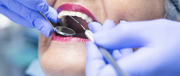 Best Emergency Treatment for Dental Infections or Abscesses in Hunter, TN